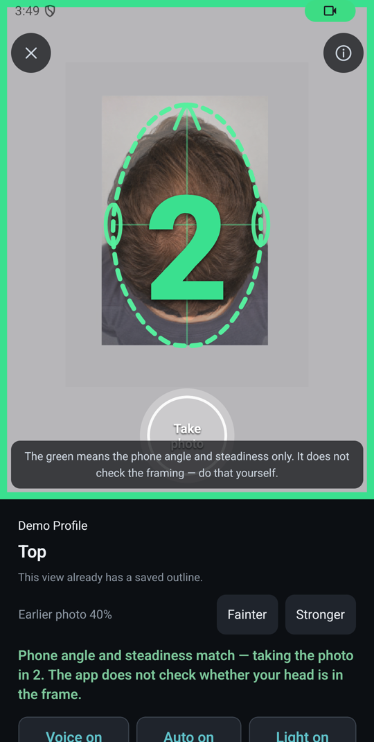 The capture screen of the GraftView app: the previous photograph laid over the live camera, an elliptical guide and the angle and distance readout.