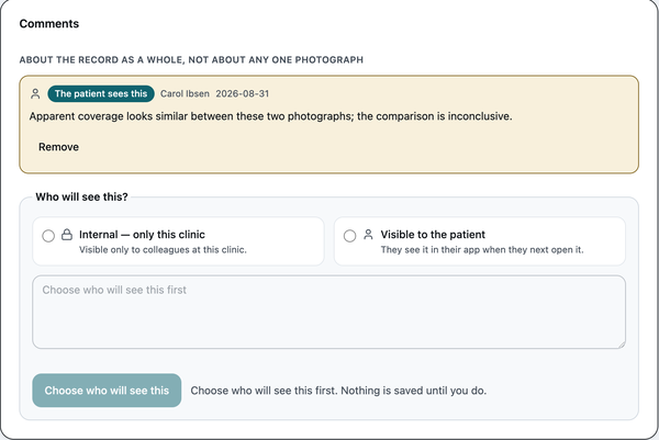 The GraftView clinician panel: a comment from a clinician on a patient’s record, marked as visible to the patient.