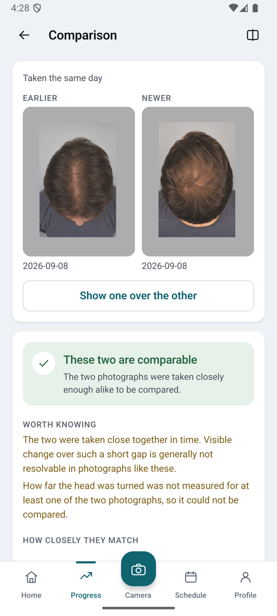 The comparison screen of the GraftView app: two photographs of the same view side by side, with the comparison quality shown above them.